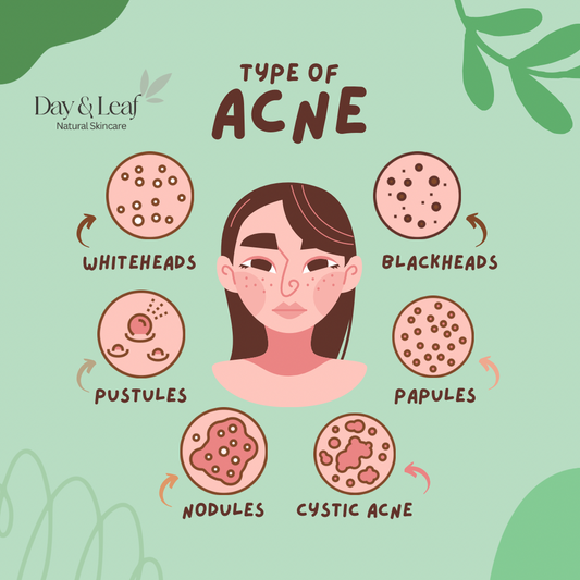 Before Day & Leaf I Didn’t Care About Skincare – Now I Get It